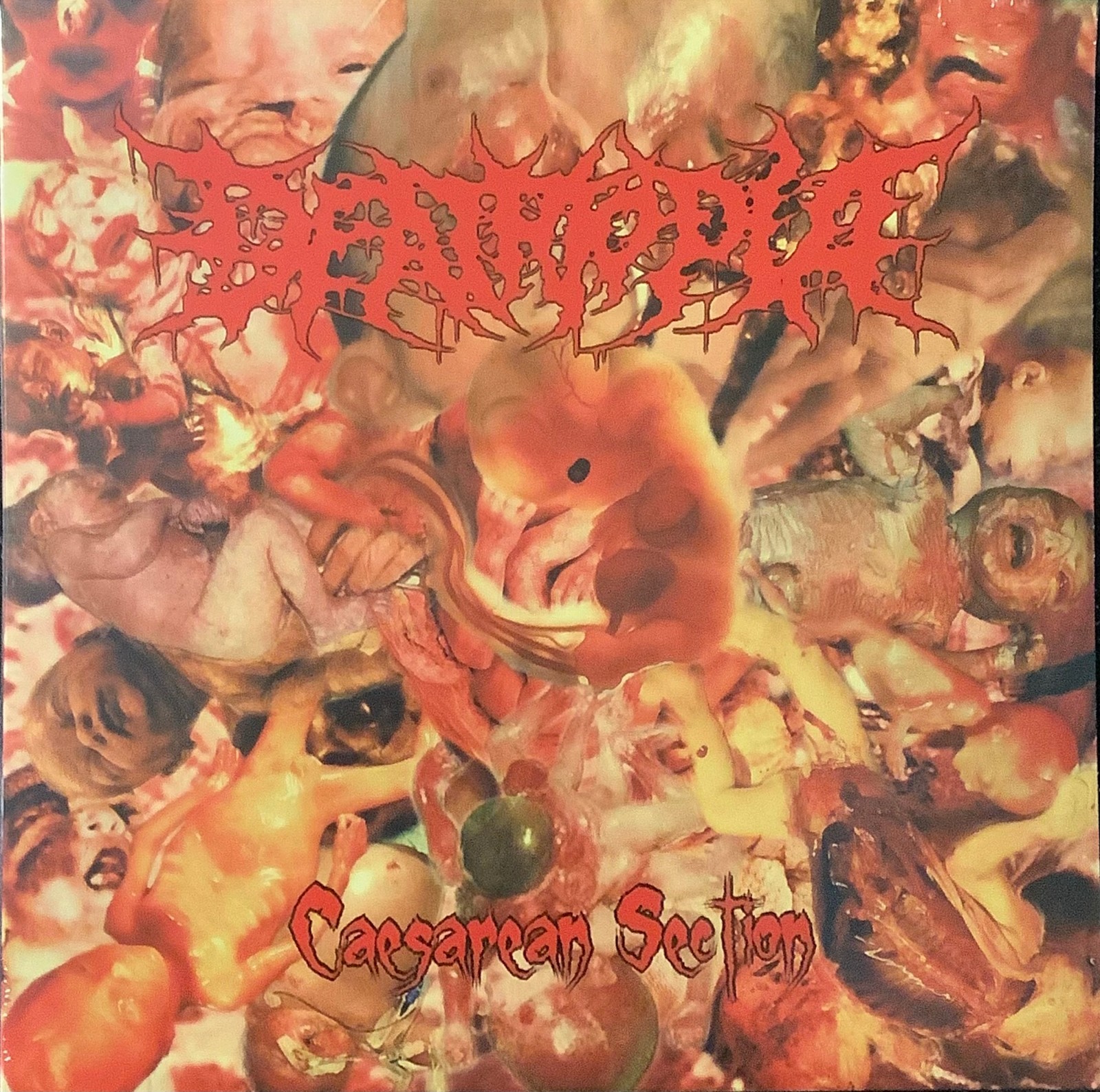 Deathtopia – Caesarean Section(LP/2015)DEPRESSION KADAVERFICKER GUT FUNEST ROT
