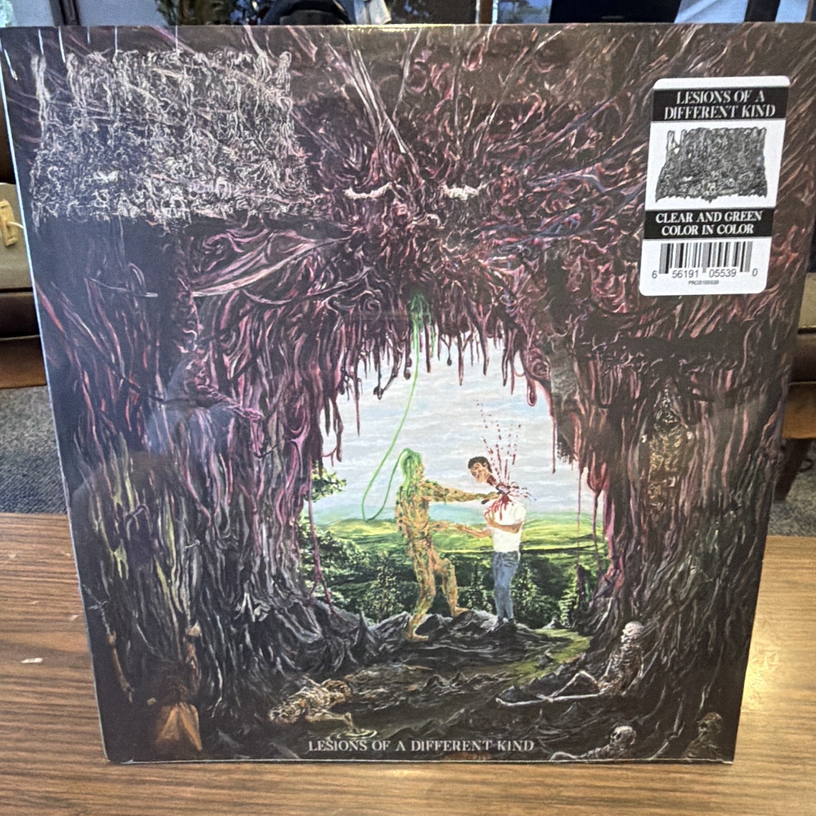Undeath Lesions of a Different Kind Vinyl LP Green/Clear /100