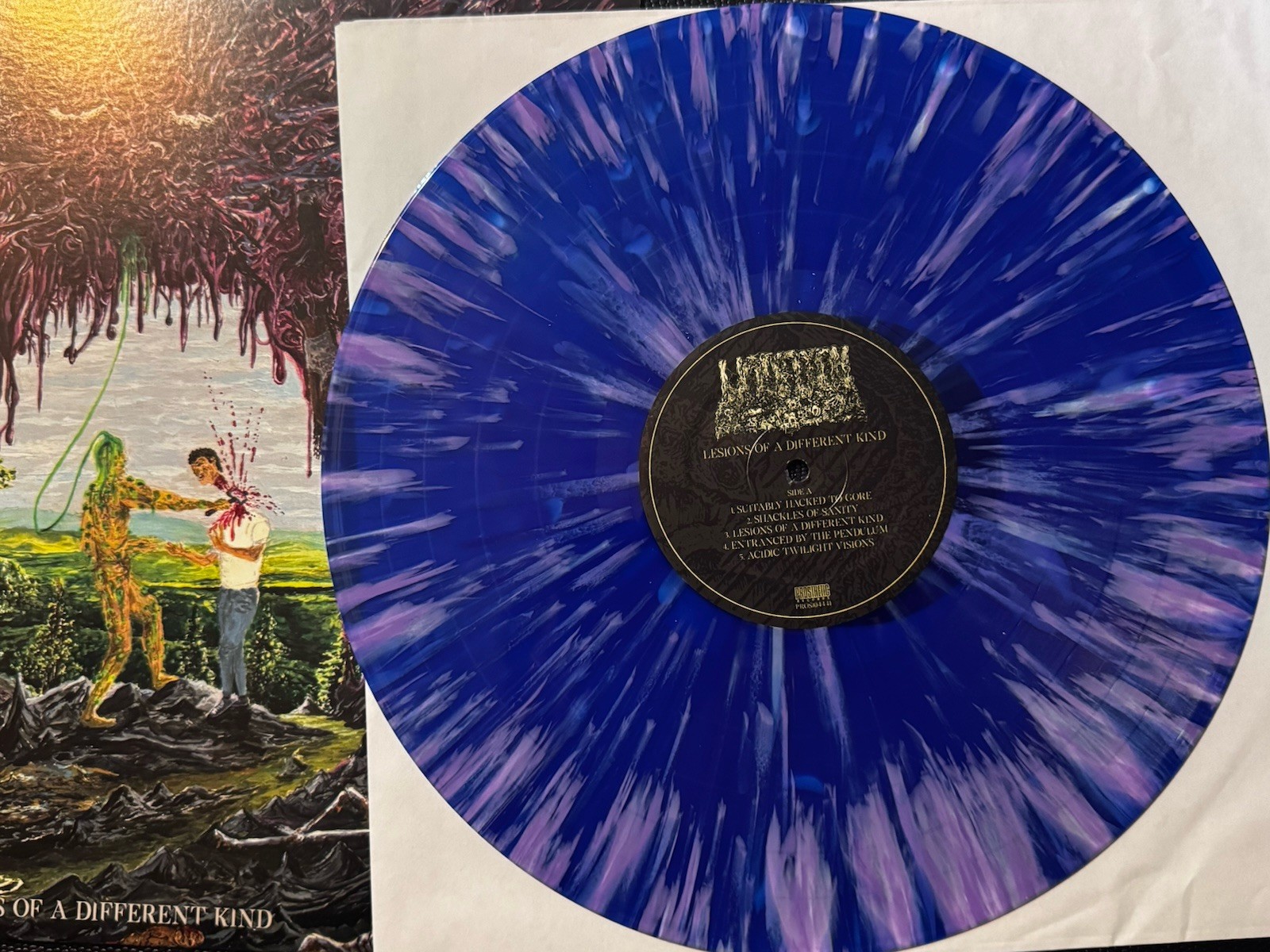 Undeath ‎– Lesions Of A Different Kind Blue With Purple Splatter