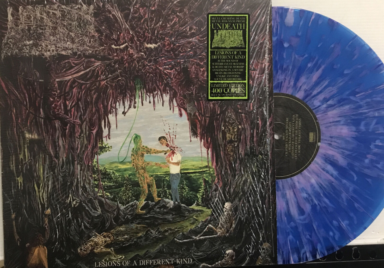 Undeath – Lesions Of A Different Kind LP 2020 Prosthetic – 104441 NM/NM [BLUE]