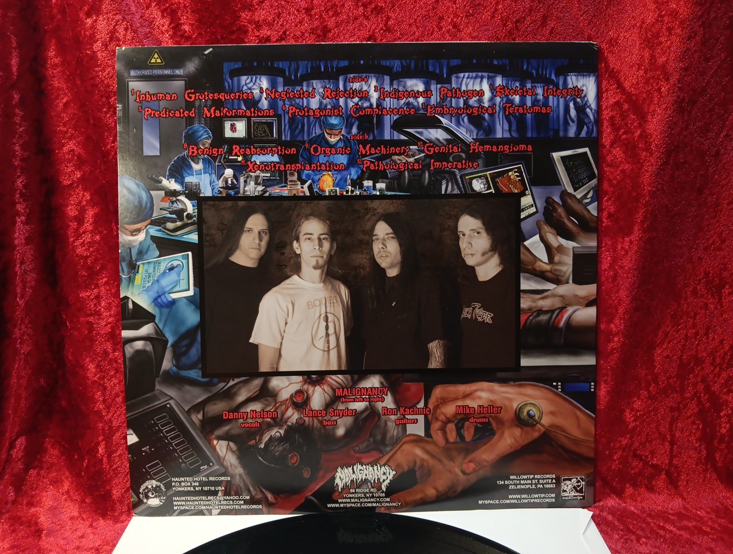 MALIGNANCY – INHUMAN GROTESQUERIES LP – Mortician Nile Disgorge Deaden Lividity