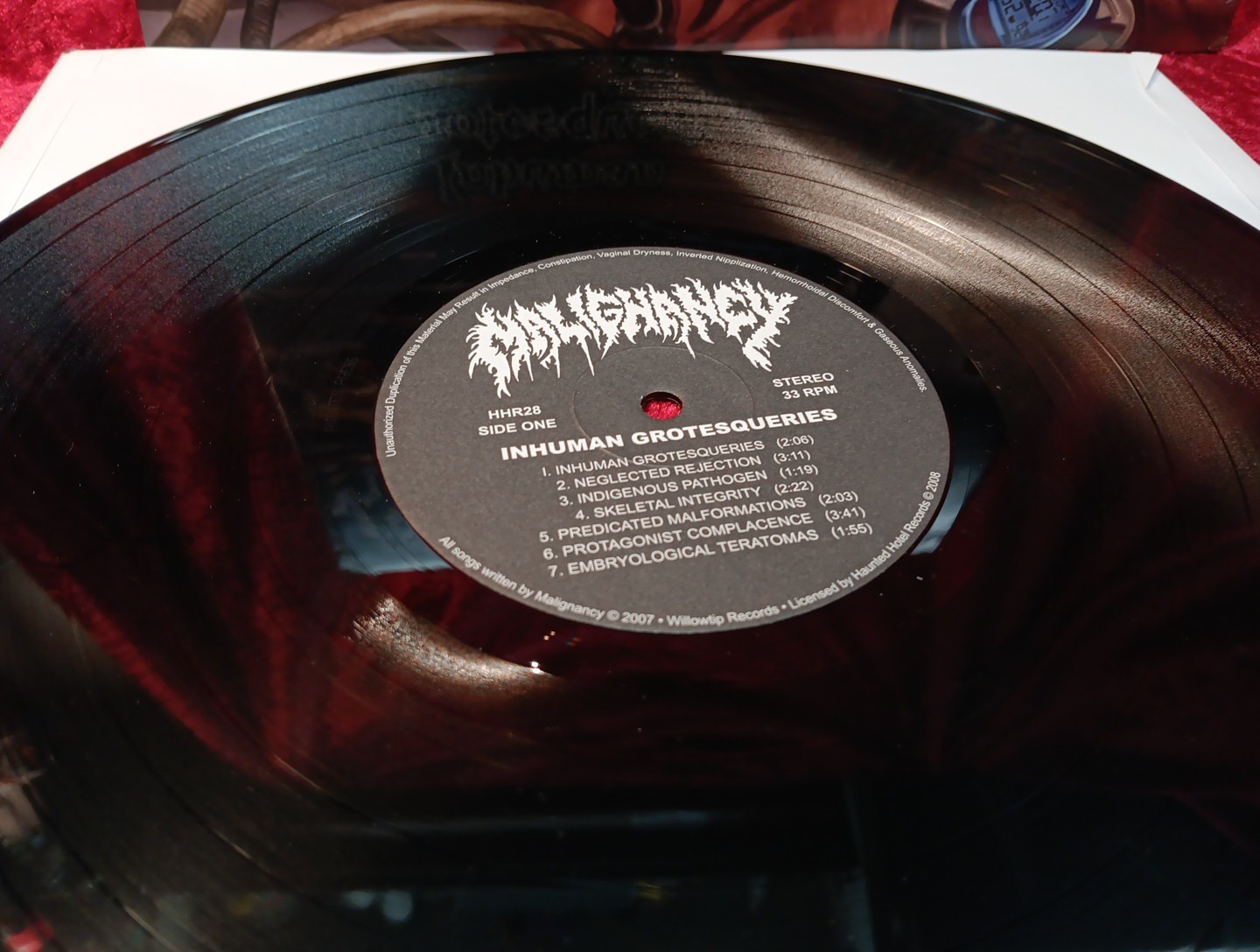 MALIGNANCY – INHUMAN GROTESQUERIES LP – Mortician Nile Disgorge Deaden Lividity