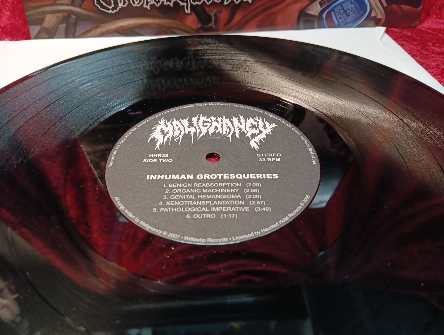 MALIGNANCY – INHUMAN GROTESQUERIES LP – Mortician Nile Disgorge Deaden Lividity
