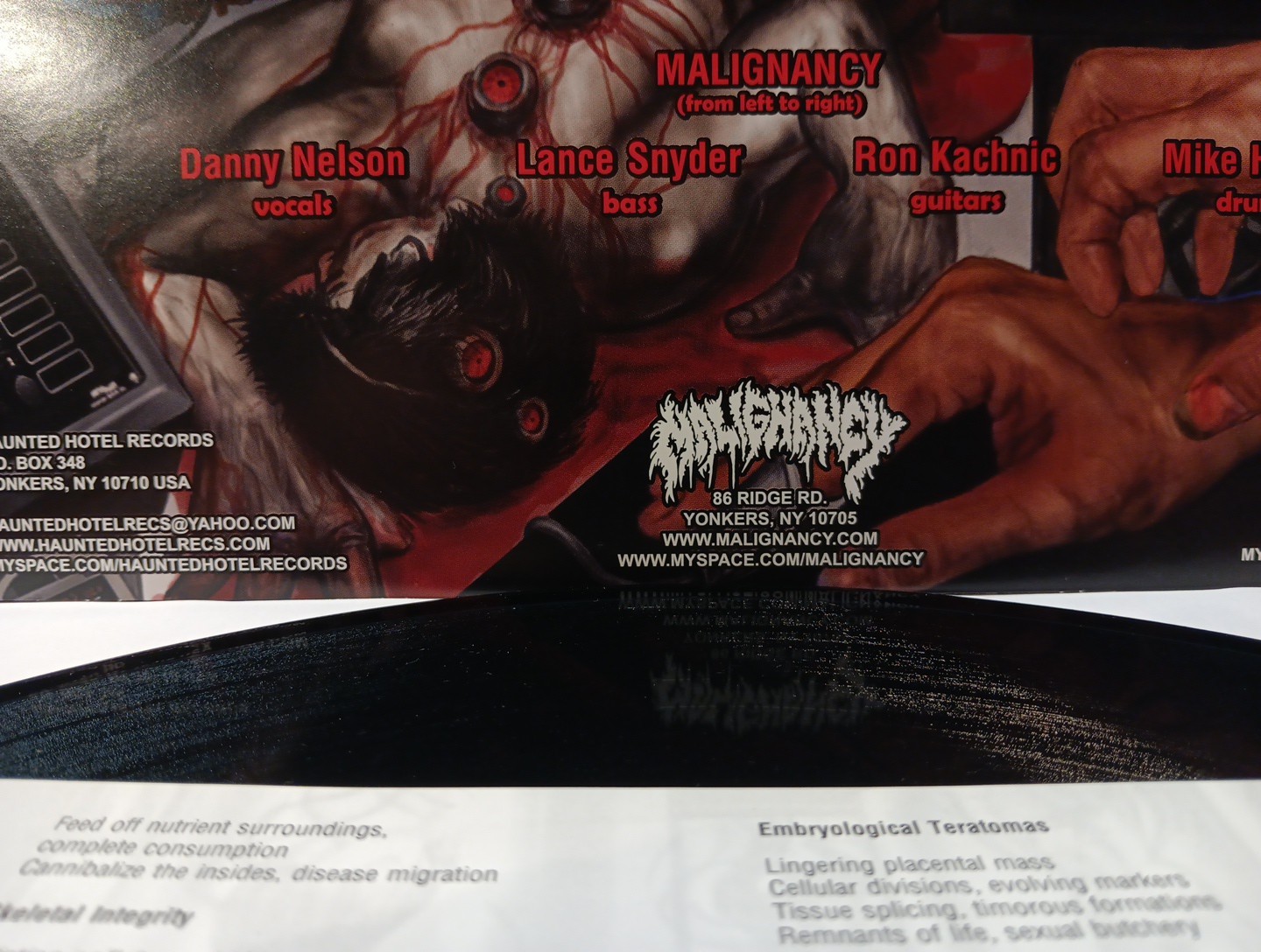MALIGNANCY – INHUMAN GROTESQUERIES LP – Mortician Nile Disgorge Deaden Lividity